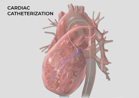 cardiac-catheterization