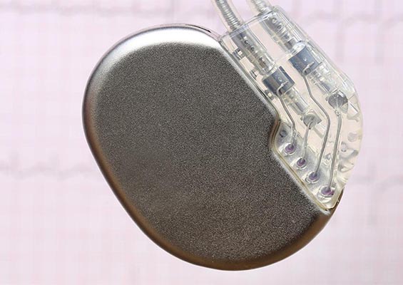 pacemaker-implantation